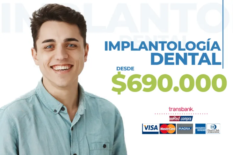 Servicio: Implantología Dental